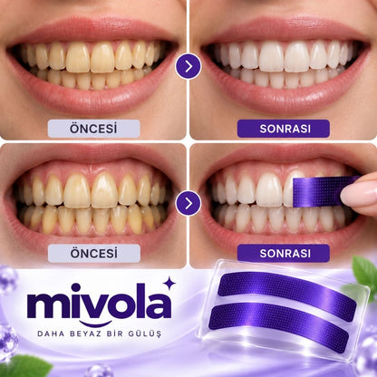 Mivola Diş Beyazlatma Bantları