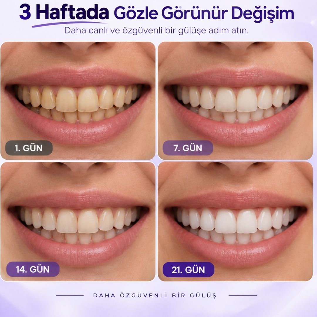 Mivola Diş Beyazlatma Bantları